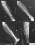 Annecy X-rays