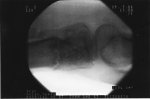 Right knee X-ray